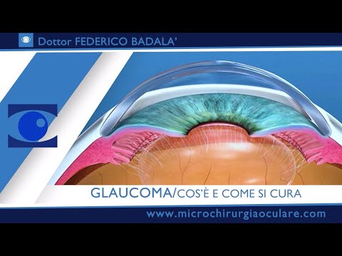 Glaucoma: scopri il costo dell&#8217;intervento laser, solo 70 caratteri!